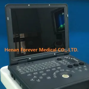 4D Color Laptop Doppler Ultrasound thumbnail-1