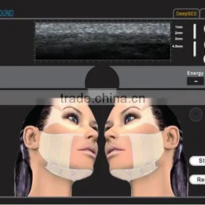 2016 New Promotion High Intensity Focused Ultrasound Eyes Wrinkle Removal Hifu Machine/ 2016 Hifu Deep Wrinkle Removal thumbnail-2