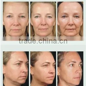 AYJ-C19(CE) Dot Matrix Portable Thermal rf Beauty Equipment Fractionel thumbnail-6
