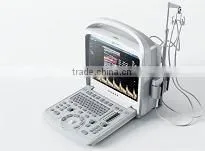 Hot Sale Color Doppler Ultrasound Machine for Sale thumbnail-2