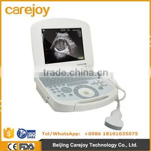 Cheap Price Portable Ultrasound Scanner With 3.5Mhz Convex Probe Manufacturer thumbnail-1