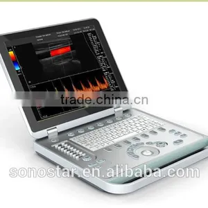 Very Cheap and Great Quality 4D Doppler Ultrasound Machine thumbnail-1