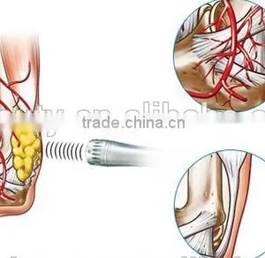 2016 New Physiotherapy Extracorporeal Shoulder Pain Therapy Equipment Shockwave Machine thumbnail-6