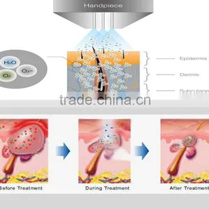 Multi Function Skin Care Equipment Oxygen Therapy Devices thumbnail-3