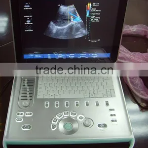 New Type Laptop Color Doppler Ultrasound for Human With Laptop thumbnail-1
