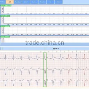 CE Approved 12 Channel Mini 24/48-hour LCD ECG Holter Recorder System With Premier Holter Software-ECGLAB thumbnail-5