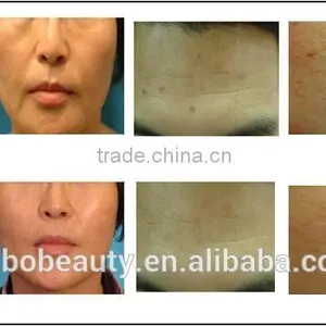 TaiBo Beauty Professional Portable Fractional rf Machine/rf Fractional Micro Needle/fractional rf Microneedle Machine thumbnail-6