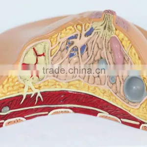 Medical Breast Disease Model Breast Anatomical Model Medical Training Model Breast Feeding Model thumbnail-1