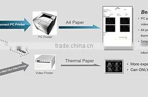 ECO2 High Image Quality Good Price Black and White Portable Ultrasound Chison thumbnail-5