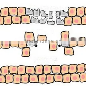 For Skin Resurfacing, Vaginal Tightening rf Fractional Co2 Laser thumbnail-5