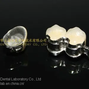 Dental Precision Attachment, Dental Attachment, Dental Denture, Laboratoire Dentaire, Dentallabor, Laboratorio Dental, Dental Laboratory, Shenzhen LJ Dental Lab China thumbnail-3