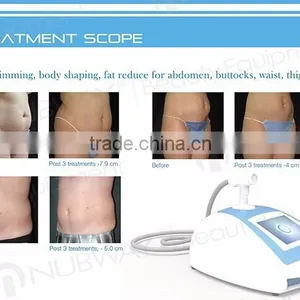 High Quality Portable HIFUSHAPE Liposuction Abdomen Fat Removal Machine for Slimming thumbnail-4
