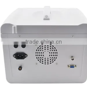 Good Image Ultrasound Machine With Linear Transvaginal Convex Microconvex Rectal Probe thumbnail-4