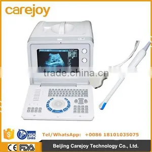 Low Cheap Portable Ultrasound Scanner 10 Inch Optional Video Thermal Recorder thumbnail-1
