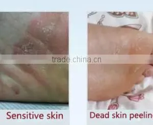 Guojia Peeling Foot Mask thumbnail-4