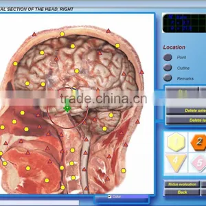 Fast Detection Diacom 3D Body Health Analyzer thumbnail-3