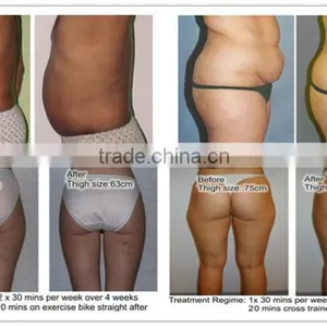 650nm Portable Lipo Diode Laser Slimming Machine for Sale thumbnail-5