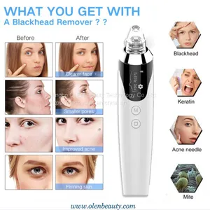 OLEN 2020 Home Use Portable Facial BlackHead Spot Acne Remover Machine Cleanser Comedo Cleaner for Black Head Removal Vacuum Device thumbnail-2