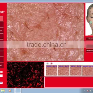 5.0 Mega Pixels Skin Analysis Device With Clear and Accurate Images thumbnail-5