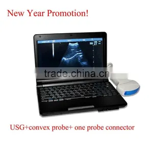 CE Approved Laptop Ultrasound Scanner With 3.5Mhz Multi-frequency Convex Probe RUS-9000F thumbnail-1