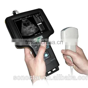 Sonostar Good Quality Handheld Portable Vet Ultrasound Scanner Pig Veterinary Ultrasound V6 thumbnail-3