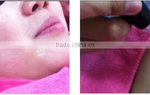 Portable Facial Machine 2016 Mini Portable Water Oxygen Spary Skin Rejuvenation/water Oxygen Jet Peel Machine Diamond Dermabrasion thumbnail-5