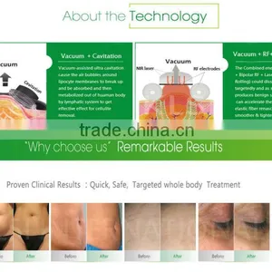 KLSi Best Beauty Salon Equipment/machine Ultrasonic Cavitation Machine thumbnail-4