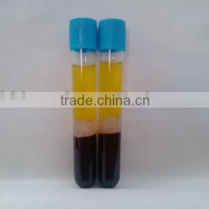 Platelet Rich Plasma Tube With Hundred Grade Workbench thumbnail-1