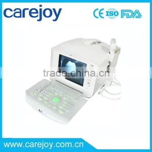 Promotion!!CE Approved Portable USB Ultrasound Scanner With 3.5Mhz Multi-frequency Convex Probe RUS-6000A thumbnail-1