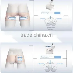 Professional Radio Frequency Cellulite Roller Massage Fat Dissolving Machine - Cellactor thumbnail-6