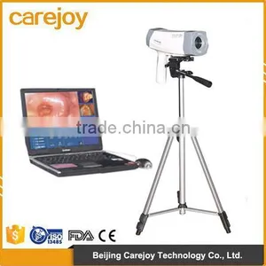 Factory Price 2016 Hot Sale Electronic Portable Digital Video Colposcope for Gynecology thumbnail-1