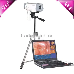 Sale Digital Electronic Colposcope With CCD Sony Camera 800,000 Pixels With Analysis Software Vaginalitis Cervical Diagnosis thumbnail-1