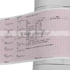 Portable Digital 6-channel Software Electrocardiograph Color Touch Screen ECG Machine EKG Machine EKG-923-Shelly thumbnail-6