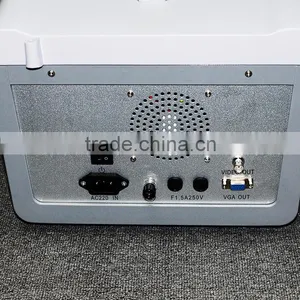 10 Inch Cheap Ultrasound Scanner Diagnostic System RUS 6000D With 3.5MHz Convex Probe 18 Months Warranty thumbnail-4