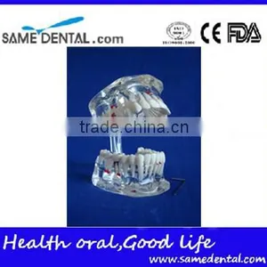 Dental Adult Pathological Dentition Model DEA-48 Teeth Model Teaching Demonstration thumbnail-2
