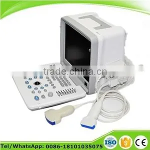 12 Inch Portable Ultrasound Scanner With External 3D Workstation Optional thumbnail-1