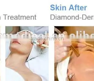 Electric Exfoliate Massager Microdermabrasion Machine,crystal Microdermabrasion Beauty Machine thumbnail-5