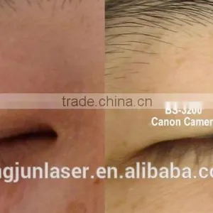 Boxy Skin and Hair Analyzer Scope 3D Portable Skin Analyzer for Skin Testing thumbnail-6