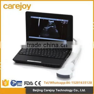 CE & ISO Approved Full Digital Laptop Ultrasound Scanner thumbnail-1