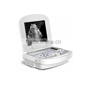 China Beijing 10.7 Inch Color LCD 2B Ultrasound Imaging System Laptop Ultrasound Scanner With CE ISO Approved thumbnail-5
