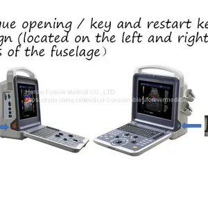Portable Color Doppler Ultrasound Scanner System thumbnail-3