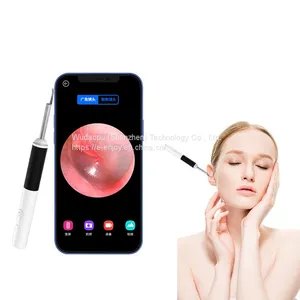 Smart Visual Ear Stick Endoscope Earwax Removal Ear Otoscope thumbnail-1