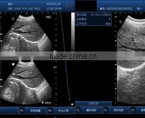 Best Price Pocket Ultrasonic Diagnostic Wireless Ultrasound Probe 10 Years Export Experience Supplier -WBU01 thumbnail-6