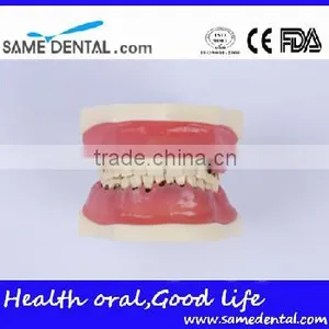 Dental Severe Periodontal Disease Model School Teaching thumbnail-2