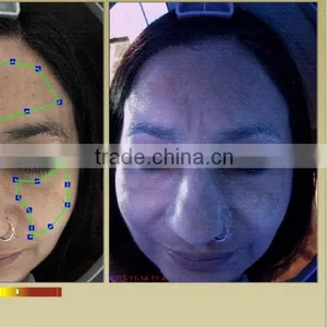 Salon & Cinilic Beauty Machine Skin Diagnose Magic Mirror/skin Analyzer/skin Tester thumbnail-4