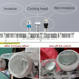 Advanced 2 in 1 Fractional Micro Needle RF Thermagic RF Microneedle for Deep Anti-aging and Wrinkle Removal thumbnail-3