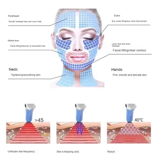 Multi-Function Anti-Aging Device: RF, EMS, LED for Face & Body thumbnail-5