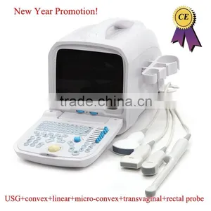 CE Approved Portable PC Ultrasound Scanner/Ultrasound Machine With 3.5Mhz Multi-frequency Convex Probe RUS-9000A thumbnail-1