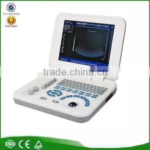 Low Price Portable Ultrasound Machine Mini Laptop Ultrasound Scanner thumbnail-1