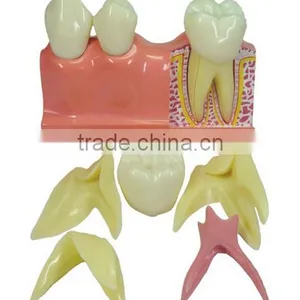 Medical Tooth Dental Anatomical Models for Training thumbnail-1
